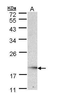 UBE2G2 antibody [N1C3]