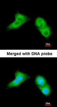 UBE2G2 antibody