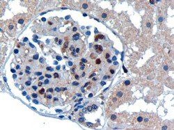 Goat anti-UBE2I Antibody