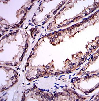 UBE2I Antibody