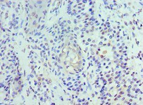 UBE2J2 Antibody