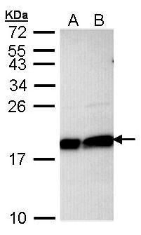 ubiquitin conjugating enzyme E2 L3 Antibody