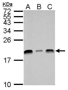 ubiquitin conjugating enzyme E2 L3 Antibody