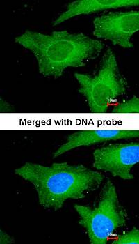 Ube2L3 antibody