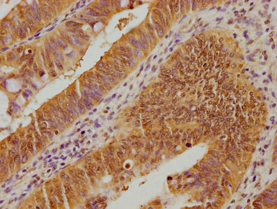 UBE2M Antibody