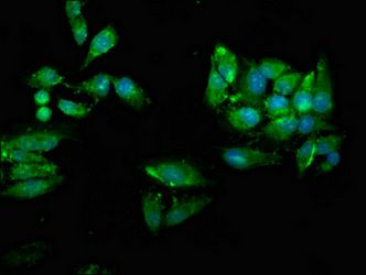 UBE2N Antibody