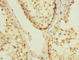 UBE2S Antibody