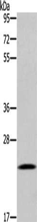 UBE2S antibody