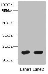 UBE2T antibody