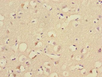 UBE2Z Antibody