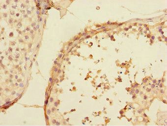 UBE2Z Antibody