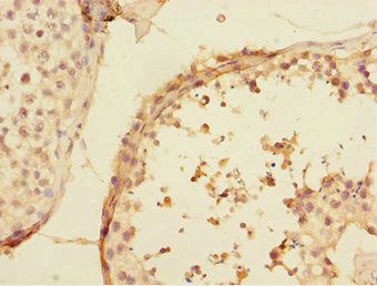 UBE2Z antibody