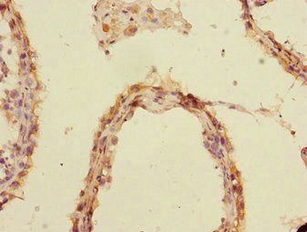 UBE2Z Antibody