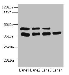 UBE2Z antibody