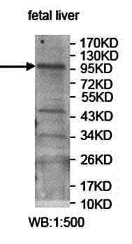 UBE3A Rabbit Polyclonal Antibody