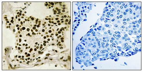UBF (Phospho-Ser484) Antibody