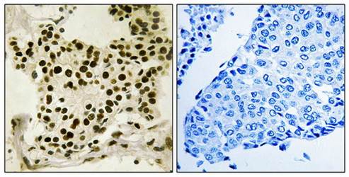 UBF (phospho-Ser484) antibody