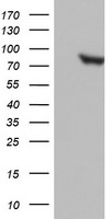 Ubiquinol Cytochrome C Reductase Core Protein I Antibody