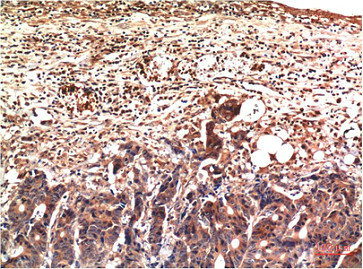 Ubiquitin Antibody