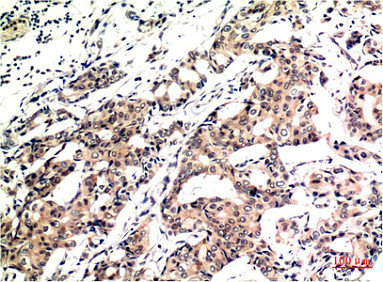 Ubiquitin Antibody