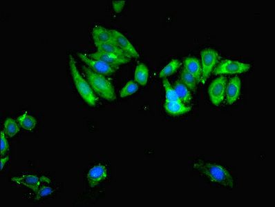 Ubiquitin carboxyl-terminal hydrolase 14 antibody