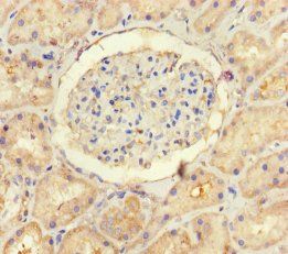 USP14 Antibody