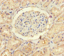 Ubiquitin carboxyl-terminal hydrolase 14 antibody