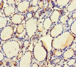 Ubiquitin-conjugating enzyme E2 Q2 antibody