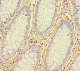 Ubiquitin-like-conjugating enzyme ATG3 antibody