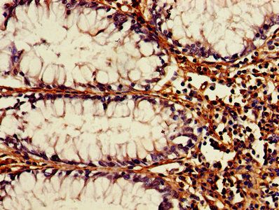ATG3 Antibody