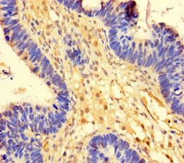 Ubiquitin thioesterase OTUB1 antibody