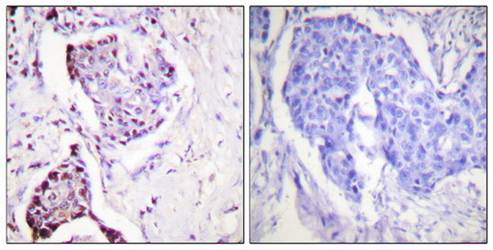 Ubiquitin Antibody