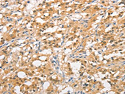 UBQLN1 Antibody