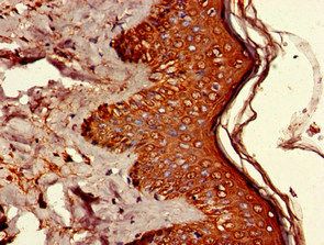 UBQLN1 Antibody
