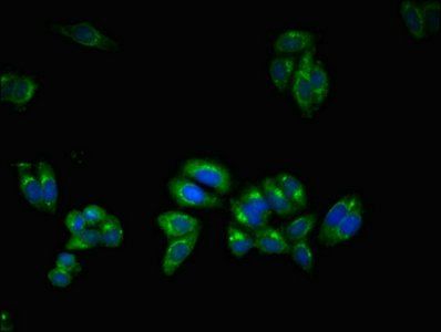 UBQLN2 Antibody