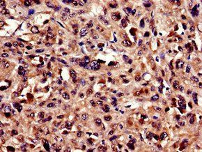 UBQLN2 Antibody