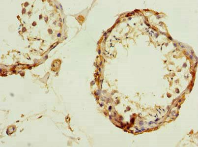 UBQLNL Antibody