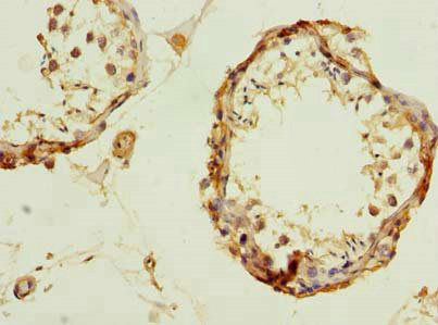 UBQLNL antibody