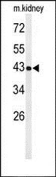 UBXN6 antibody