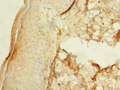 UBXN6 Antibody