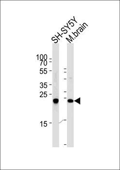 PGP9.5 antibody