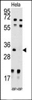 UCK2 antibody