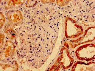 UCN2 Antibody