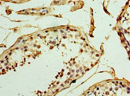 UCP1 Antibody