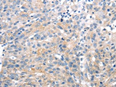 UCP2 Antibody
