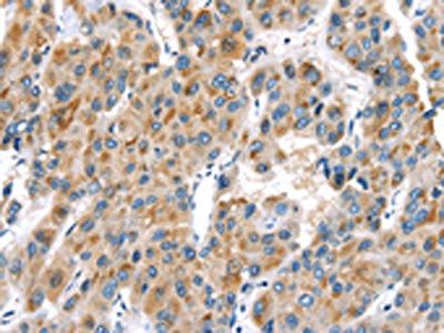 UCP2 Antibody