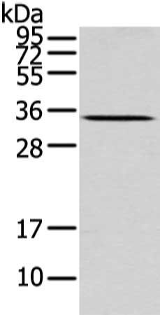 UCP2 antibody