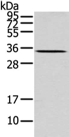UCP2 Antibody