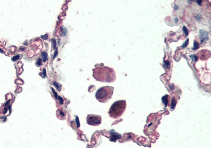 Goat anti-Uncoupling protein 2 / UCP2 Antibody