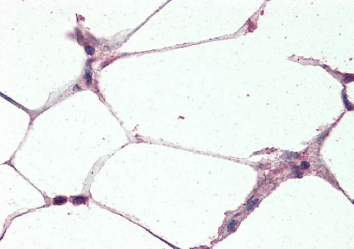 Goat anti-Uncoupling protein 2 / UCP2 Antibody